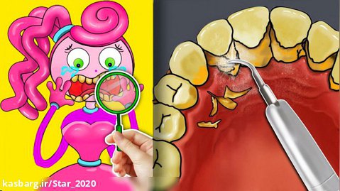 ایده کارتونی مامی لانگ لگز ، درمان پوسیدگی دندان