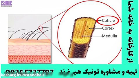 علت خشکی پوست مو سر چیست؟؟