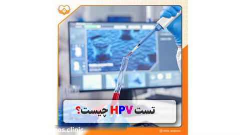 تست اچ پی وی (HPV) چیست؟