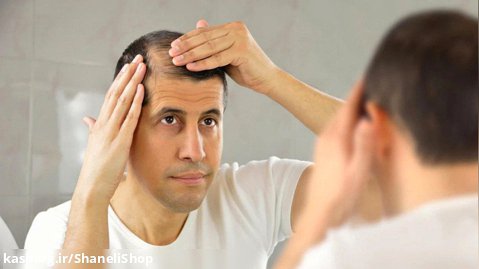 اختلال در چرخه طبیعی مو، علت اصلی ریزش!