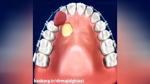 ارتودنسی دندان زیبایی