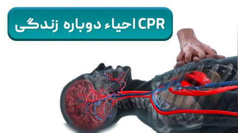عملیات CPR - نجات زندگی - دکتر مایکو