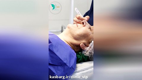 درمان افتادگی پلک در تهران بدون درد و بیهوشی- کلینیک vip