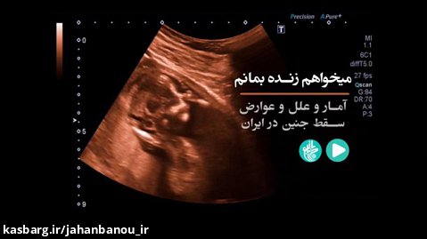 آمار، علل و عوارض سقط جنین در ایران!