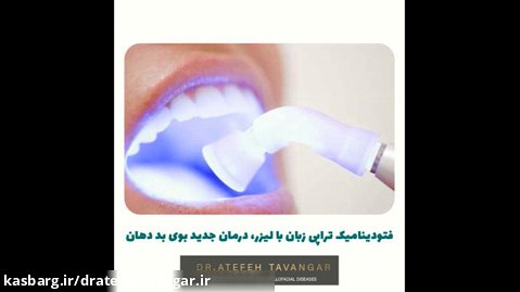درمان بوی بد دهان با لیزر (فتوداینامیک تراپی)