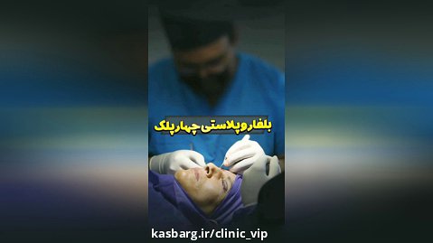 عمل بلفاروپلاستی 4 پلک در کلینیک vip تهران