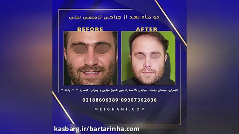 برترین ها - دکتر علی میقانی - جراحی پلاستیک و بینی و صورت