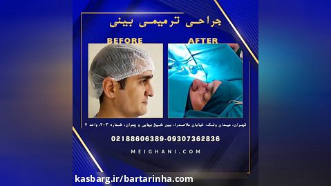 برترین ها - دکتر علی میقانی - جراحی پلاستیک و بینی و صورت