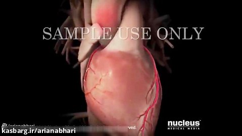 این ویدیو نشان میدهد حمله قلبی چگونه داخل بدن رخ میدهد
