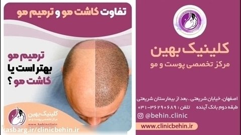 ترمیم مو بهتر است یا کاشت مو | کاشت مو اصفهان