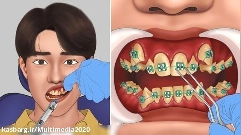 برنامه کودک دندانپزشکی _ ارتودنسی دندان