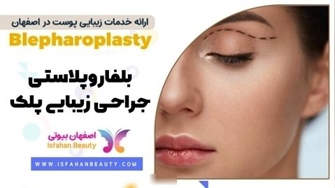 بهترین مرکز بلفاروپلاستی و جراحی پلک در اصفهان | کلینیک اصفهان بیوتی