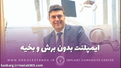 ایمپلنت بدون برش و بخیه | دکتر آرش گلستانه متخصص ایمپلنت در اصفهان