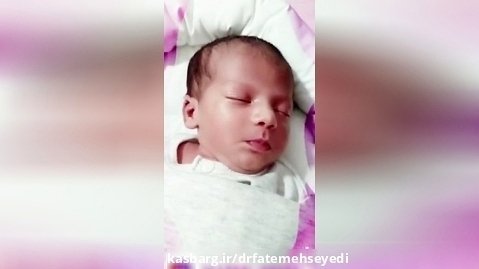 تولد نوزاد در بیمارستان مادران